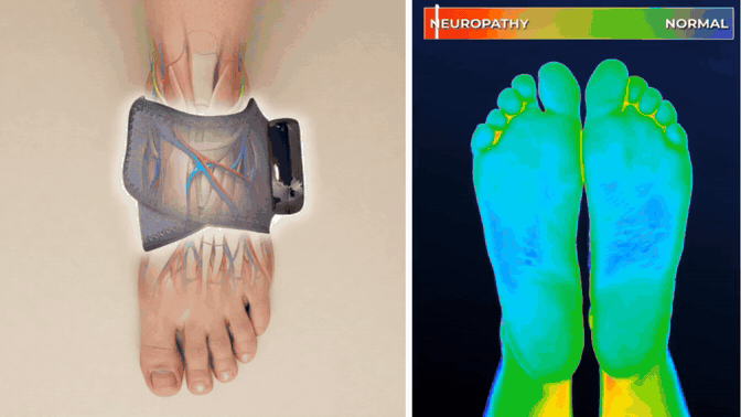 Looping animation of an EMSense foot massage wrap device massaging a foot with heat and compression